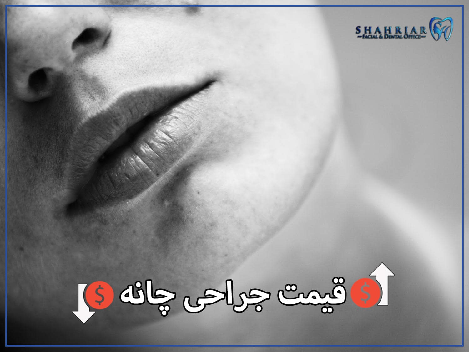 قیمت جراحی چانه